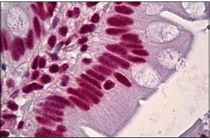 Human Small Intestine: Formalin-Fixed, Paraffin-Embedded (FFPE) (HNRNPD/AUF1 antibody)