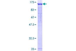 NEDD4-2 Protein (AA 1-911) (GST tag)