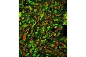Immunofluorescence (IF) image for anti-Protein tyrosine Phosphatase Type IVA, Member 2 (PTP4A2) antibody (ABIN3002826) (PTP4A2 antibody)