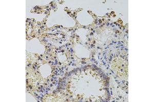 Immunohistochemistry of paraffin-embedded rat lung using PLK4 antibody. (PLK4 antibody)