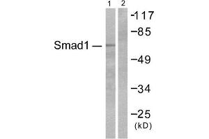 Western Blotting (WB) image for anti-SMAD, Mothers Against DPP Homolog 1 (SMAD1) (Ser465) antibody (ABIN1847896) (SMAD1 antibody  (Ser465))