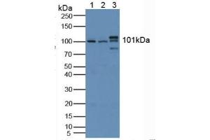 Western Blotting (WB) image for Hexokinase 1 (HK1) ELISA Kit (ABIN6574201)
