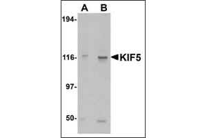 Western blot analysis of KIF5 in K562 cell lysate with this product at (A) 0. (KIF5A antibody  (C-Term))