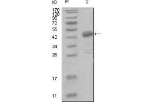 Western blot analysis using DDR1 mouse mAb against truncated MBP-DDR1 recombinant protein (1). (DDR1 antibody  (AA 602-681))