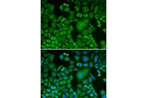 Immunofluorescence (IF) image for anti-ARP3 Actin-Related Protein 3 (ACTR3) (AA 1-418) antibody (ABIN3021339) (ACTR3 antibody  (AA 1-418))
