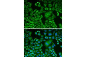 Immunofluorescence (IF) image for anti-ARP3 Actin-Related Protein 3 (ACTR3) (AA 1-418) antibody (ABIN3021339) (ACTR3 antibody  (AA 1-418))