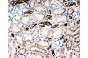 IHC-F testing of NKCC2 antibody and rat kidney tissue (SLC12A1 antibody  (N-Term))