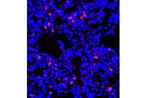 Immunofluorescence of paraffin embedded rat lung using Bora (ABIN7075236) at dilution of 1:200 (400x lens) (BORA antibody)