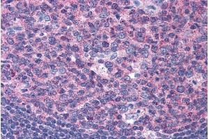 Immunohistochemistry (IHC) image for anti-Sorting Nexin 16 (SNX16) (N-Term) antibody (ABIN184967)