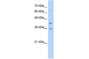 WB Suggested Anti-TMEM104 Antibody Titration:  5. (TMEM104 antibody  (Middle Region))