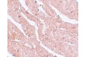 Immunohistochemistry of CAZIP in mouse heart tissue with CAZIP antibody at 5 μg/ml. (CAZIP antibody  (C-Term))