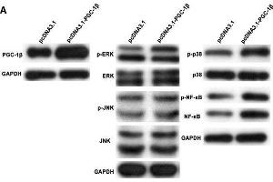 Peroxisome proliferator-activated receptor-gamma coactivator-1 β (PGC-1β) overexpression enhances proinflammatory cytokines, matrix metalloproteinases (MMPs) and receptor activator of nuclear factor-kappa B ligand (RANKL) production in rheumatoid arthritis (RA)-fibrolast-like synoviocytes (FLS). (PPARGC1B antibody  (AA 901-1023))