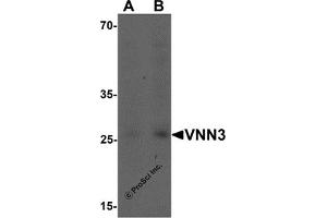 Western Blotting (WB) image for anti-Vanin 3 (VNN3) (C-Term) antibody (ABIN1077383) (VNN3 antibody  (C-Term))