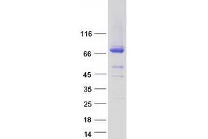 Validation with Western Blot