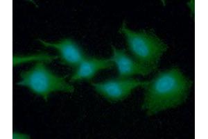 ICC/IF analysis of EEF1A1 in A549 cells line, stained with DAPI (Blue) for nucleus staining and monoclonal anti-human EEF1A1 antibody (1:100) with goat anti-mouse IgG-Alexa fluor 488 conjugate (Green). (eEF1A1 antibody)