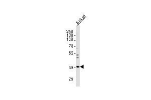 Western blot analysis of lysate from Jurkat cell line, using GLRB Antibody at 1:1000 at each lane.
