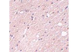 Immunohistochemical staining of human brain tissue with 5 ug/mL FRMPD4 polyclonal antibody . (FRMPD4 antibody  (Internal Region))