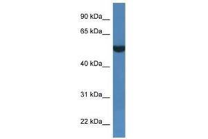 Western Blot showing FSD1L antibody used at a concentration of 1 ug/ml against THP-1 Cell Lysate