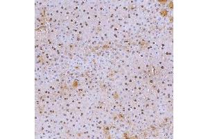 IHC analysis of SNRNP40 using anti-SNRNP40 antibody (ABIN7601719).