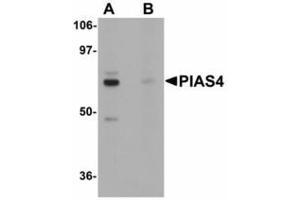 Image no. 1 for anti-Protein Inhibitor of Activated STAT, 4 (PIAS4) (N-Term) antibody (ABIN478293) (PIAS4 antibody  (N-Term))