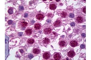 Anti-HES1 antibody IHC of human testis. (HES1 antibody  (N-Term))