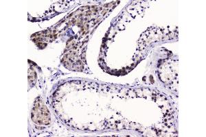 IHC analysis of SMC6L1 using anti-SMC6L1 antibody (ABIN5693133). (SMC6 antibody  (AA 205-443))