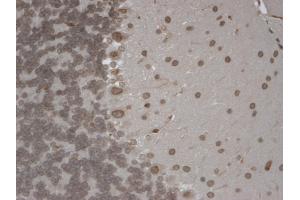 IHC analysis of TrpM7 tested on mouse brain using a dilution of TRPM7 antibody. (TRPM7 antibody  (AA 1817-1863))