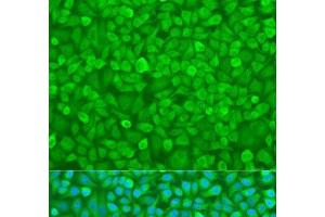 Immunofluorescence analysis of U2OS cells using YTHDF3 Polyclonal Antibody at dilution of 1:100. (YTHDF3 antibody)