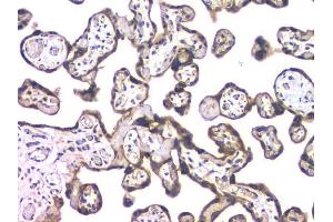 IHC analysis of HDAC5 using anti-HDAC5 antibody (ABIN6719321). (HDAC5 antibody  (AA 102-197))