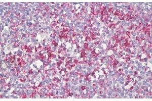 Anti-SLC2A3 / GLUT3 antibody IHC staining of human tonsil, germinal center. (SLC2A3 antibody  (AA 447-496))