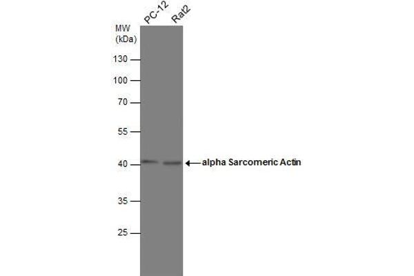 Actin, gamma 1 antibody  (N-Term)