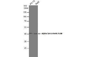 WB Image Various whole cell extracts (30 μg) were separated by 10% SDS-PAGE, and the membrane was blotted with alpha Sarcomeric Actin antibody , diluted at 1:1000. (Actin, gamma 1 antibody  (N-Term))