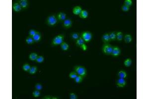Image no. 7 for anti-Acetyl-CoA Acetyltransferase 2 (ACAT2) antibody (ABIN1496402) (ACAT2 antibody)
