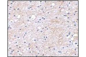 Immunohistochemical staining of human brain tissue using AP30496PU-N at 2. (LGI1 antibody  (Center))