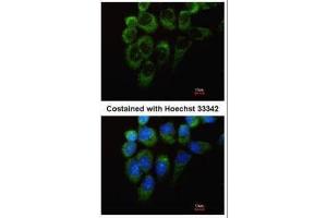 ICC/IF Image Immunofluorescence analysis of methanol-fixed A431, using Tyrosyl tRNA synthetase, antibody at 1:200 dilution. (YARS antibody  (C-Term))