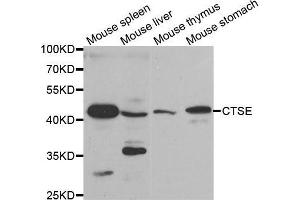 Western blot analysis of extracts of various tissues, using CTSE antibody. (Cathepsin E antibody)
