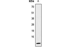 Western blot analysis of IL-8 expression in HeLa (A) whole cell lysates. (IL-8 antibody  (Center))