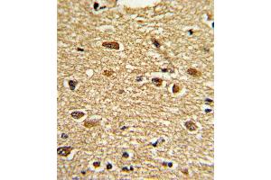 Formalin-fixed and paraffin-embedded human brain tissue reacted with ETV4 Antibody , which was peroxidase-conjugated to the secondary antibody, followed by DAB staining. (ETV4 antibody  (C-Term))