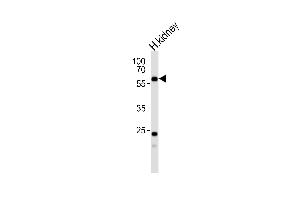 Western blot analysis of lysate from human kidney tissue lysate, using PFKFB3 Antibody  (ABIN392768 and ABIN2842213). (PFKFB3 antibody  (C-Term))