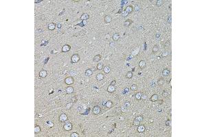 Immunohistochemistry of paraffin-embedded rat brain using SPP1 antibody (ABIN1874927) at dilution of 1:100 (40x lens). (Osteopontin antibody)