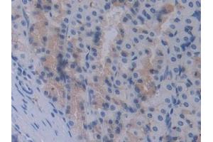 Detection of STAM1 in Rat Stomach Tissue using Polyclonal Antibody to Signal Transducing Adaptor Molecule 1 (STAM1)
