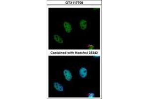 Image no. 1 for anti-Chromodomain Protein, Y-Like (CDYL) (AA 1-544) antibody (ABIN1497464) (CDYL antibody  (AA 1-544))