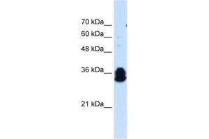 Western Blotting (WB) image for anti-Family with Sequence Similarity 134, Member B (FAM134B) antibody (ABIN2463987) (FAM134B antibody)