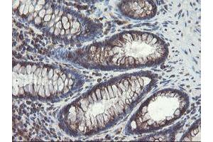 Image no. 2 for anti-Acyl-CoA Binding Domain Containing 3 (Acbd3) antibody (ABIN1498415) (ACBD3 antibody)