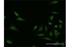 Immunofluorescence of monoclonal antibody to MKNK1 on HeLa cell. (MKNK1 antibody  (AA 1-100))