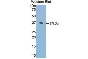 Western Blotting (WB) image for anti-Fibronectin (AA 313-607) antibody (ABIN1077665)