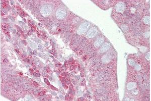 Immunohistochemistry (IHC) image for anti-Presenilin 1 (PSEN1) (Middle Region) antibody (ABIN2787886)