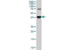SGK2 monoclonal antibody (M04), clone 4B12 Western Blot analysis of SGK2 expression in PC-12 . (SGK2 antibody  (AA 293-367))