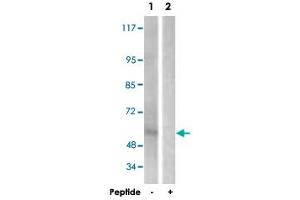Western blot analysis of extracts from HepG2 cells, using IL2RB polyclonal antibody .