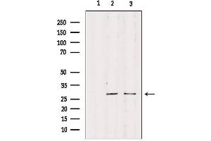 Western blot analysis of extracts from various samples, using RPS4Y1 Antibody. (RPS4Y1 antibody)